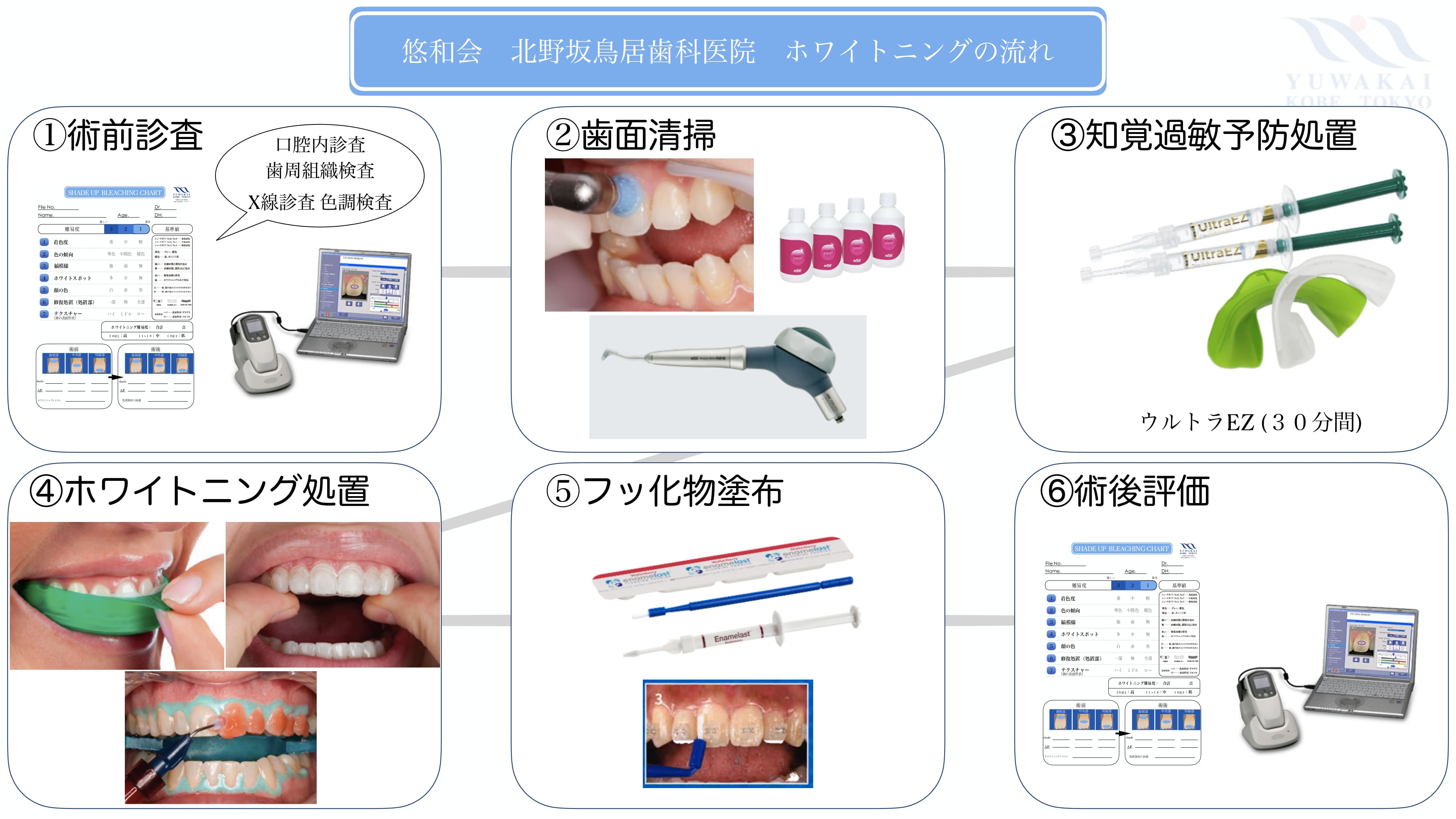 歯科　三宮　神戸　白い　ホワイトニング　オフィス　ホーム　オパールエッセンス