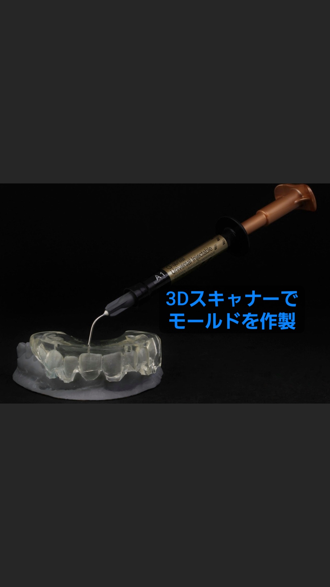 最新治療✨モールドを使った歯冠修復✨