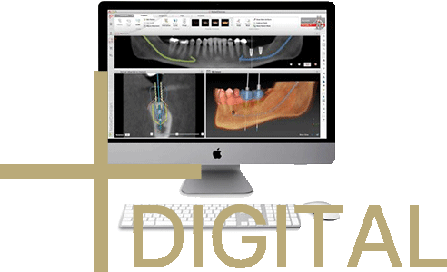 デジタルを駆使した歯科医院と技工所の連携による精度の高い技工物
